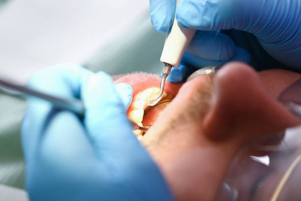 Best Walk-In Emergency Dentist in Evendale, OH
