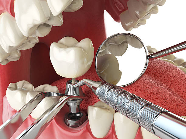 Best Emergency Dental Surgery in Evendale, OH